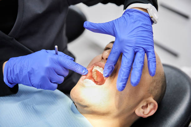 Best Chipped Tooth Repair Near Me  in North Chicago, IL