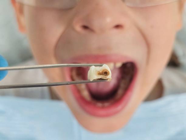Best Broken Tooth Emergency  in North Chicago, IL